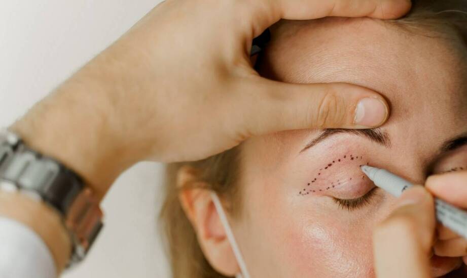 Blefaroplastyka jako część kompleksowej estetycznej terapii twarzy