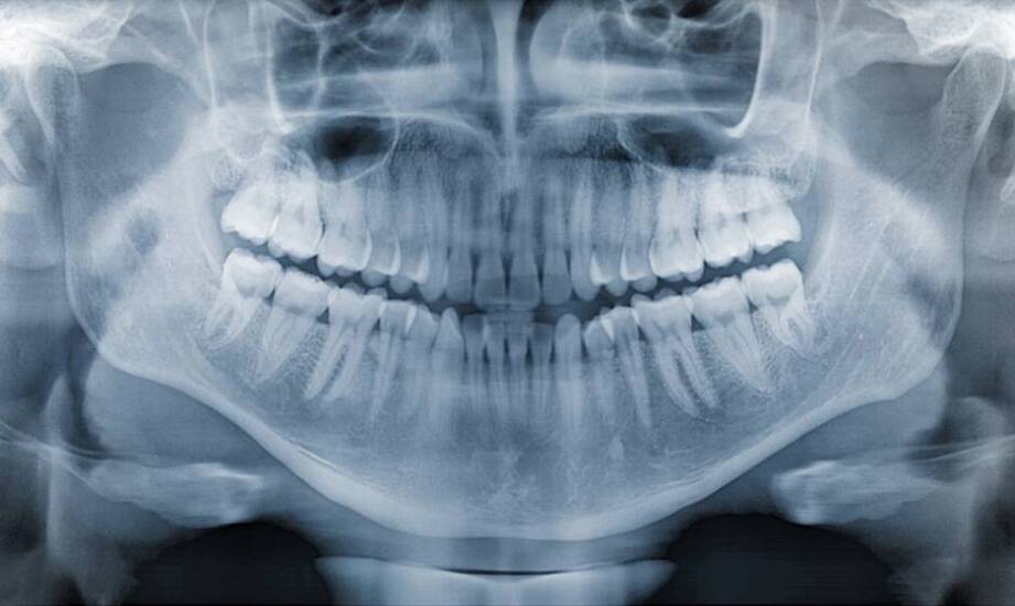 Jak RTG zębów pomaga w diagnozowaniu problemów stomatologicznych?