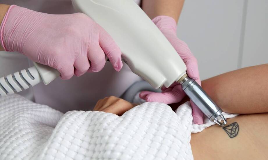 Jakie są różnice w usuwaniu ciemnych i jasnych tatuaży za pomocą lasera?