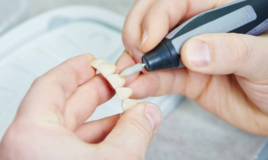 Nowoczesne technologie w tworzeniu koron i mostów na implantach