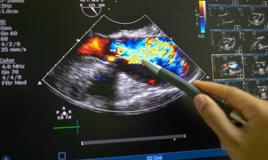 Rola ultrasonografii 3D i 4D w ocenie płodowego serca