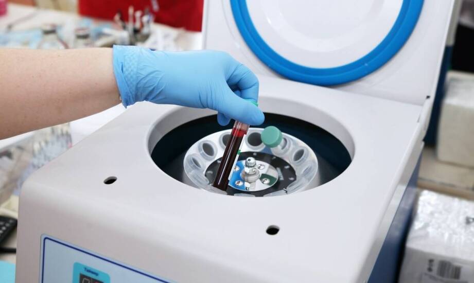 Zastosowanie wirówki do A-PRF w terapii z osoczem bogatopłytkowym