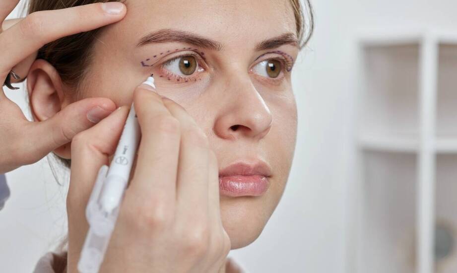 Najczęstsze pytania pacjentów dotyczące plastyki powiek.