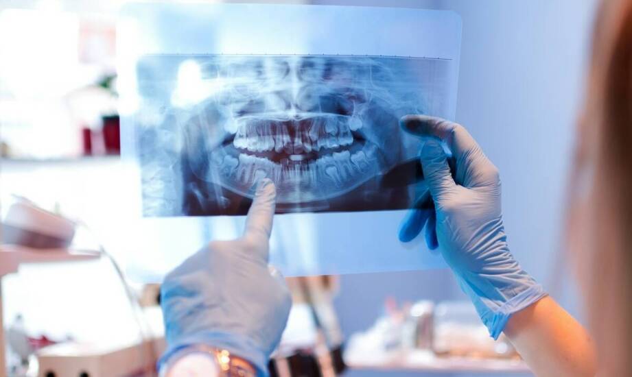 Jak rentgen zębów wspiera proces implantacji?