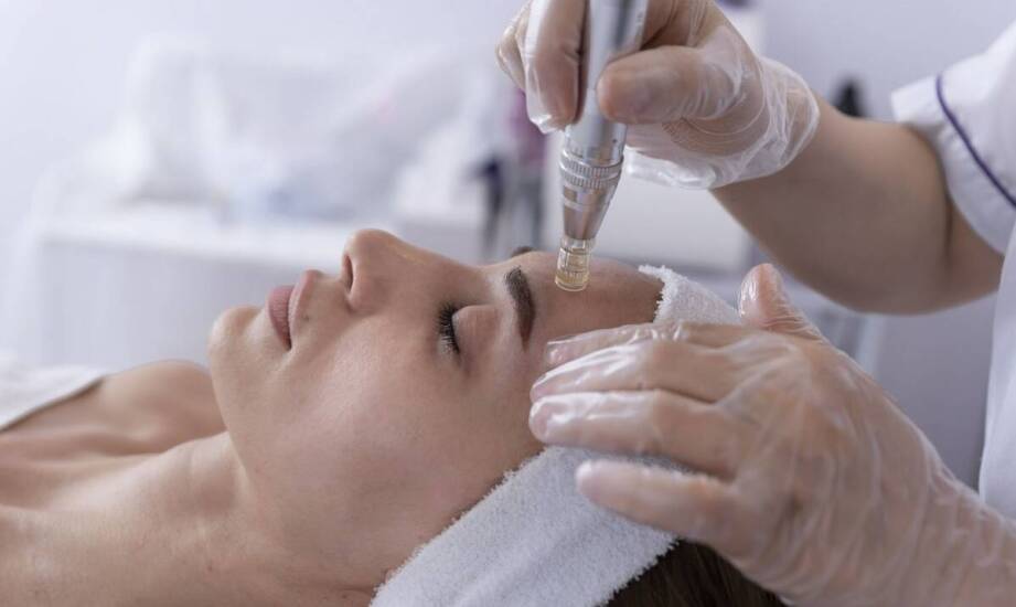 Mikroigłowa mezoterapia - klucz do młodszej skóry
