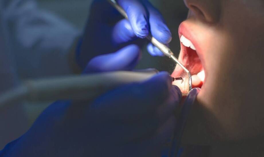 Rola endodoncji w zachowaniu zdrowia zębów – jak działa kanałowe leczenie?