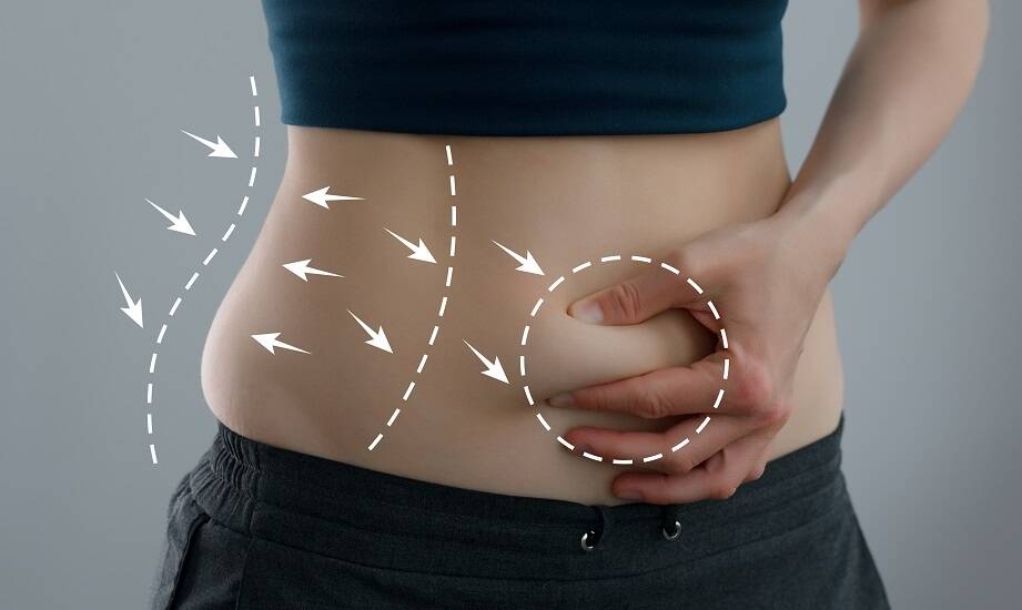 Jakie są najczęstsze pytania pacjentów dotyczące cen laserowej lipolizy?