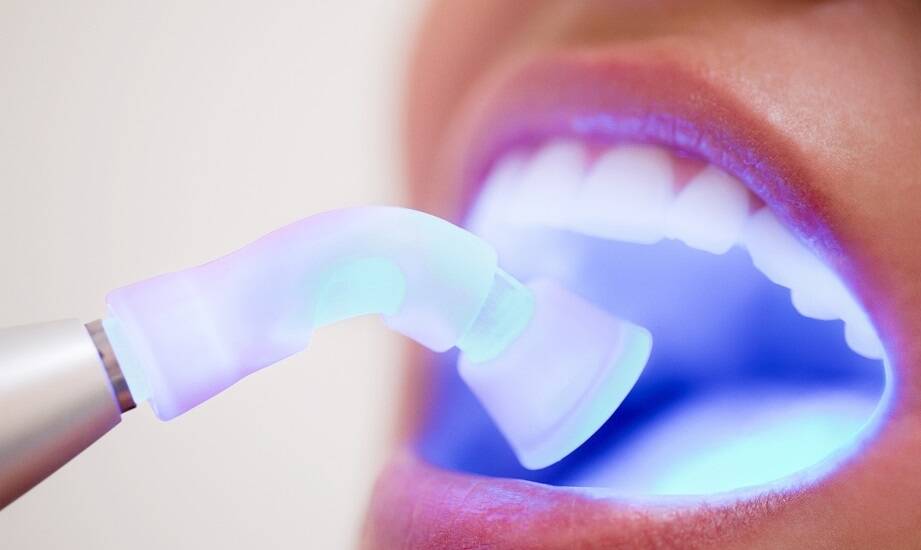 Rola polimeryzacyjnych lamp w praktyce stomatologicznej