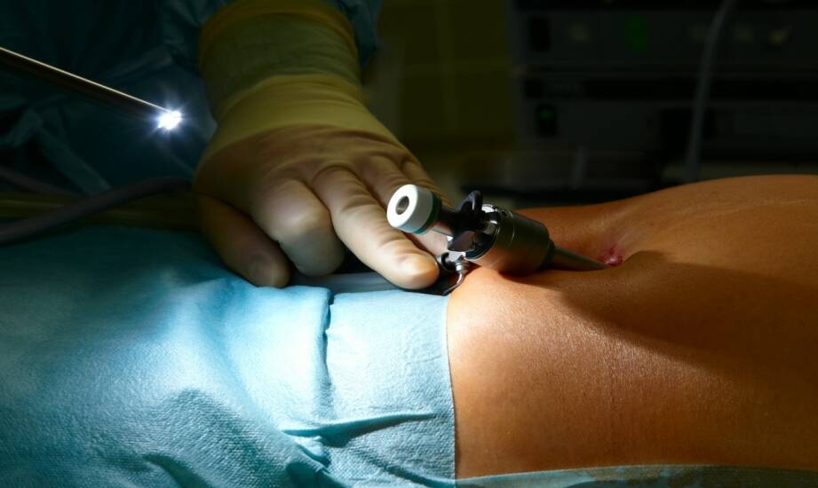 Liposukcja laserowa — co warto wiedzieć przed decyzją o zabiegu