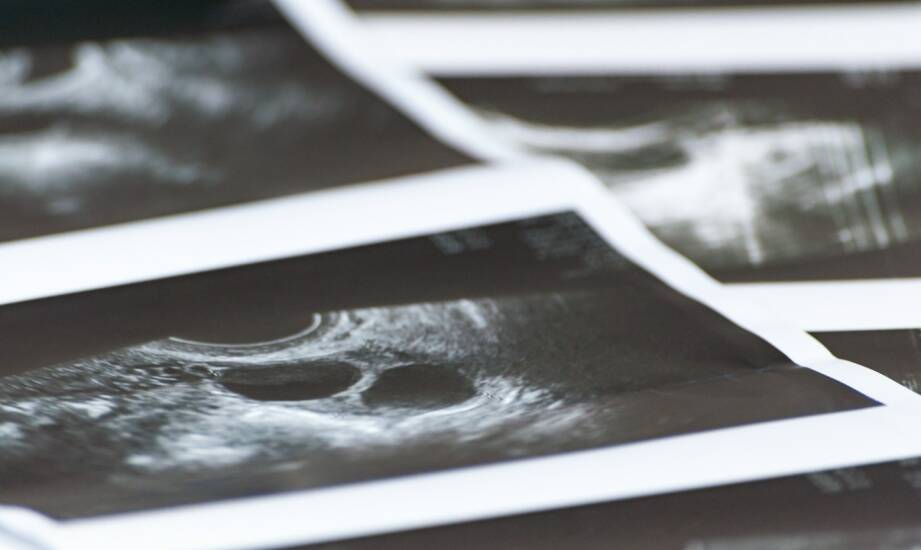 Zdjęcie pantomograficzne — co warto wiedzieć przed wykonaniem badania