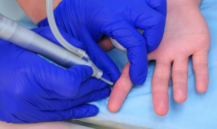 Mezoterapia osoczem bogatopłytkowym: co warto wiedzieć przed zabiegiem