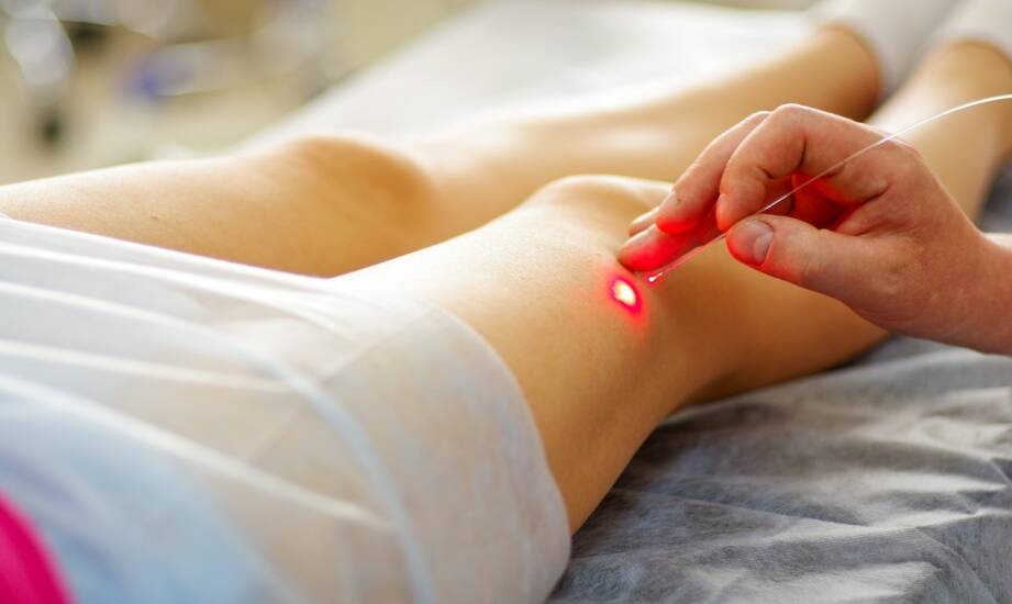 Laseroterapia: co warto wiedzieć przed pierwszym zabiegiem