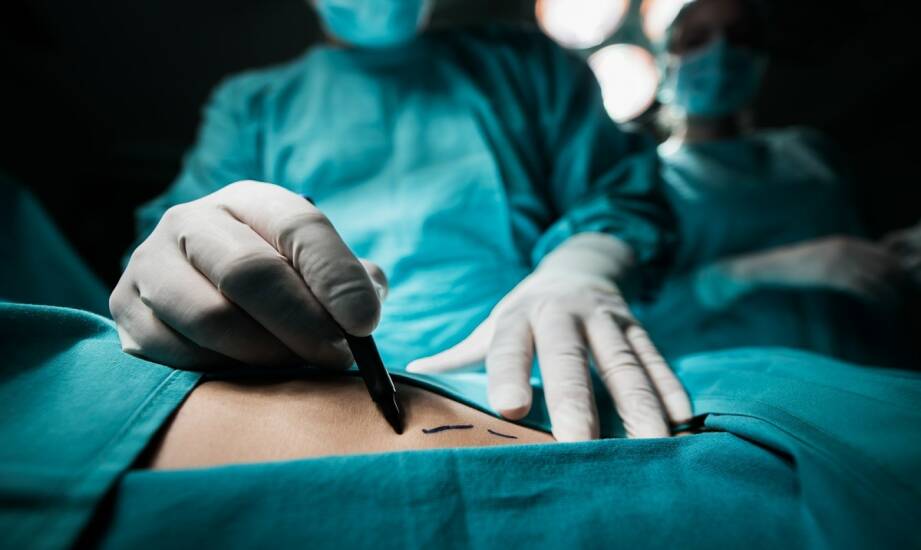Wazektomia: co warto wiedzieć przed decyzją o zabiegu sanitario