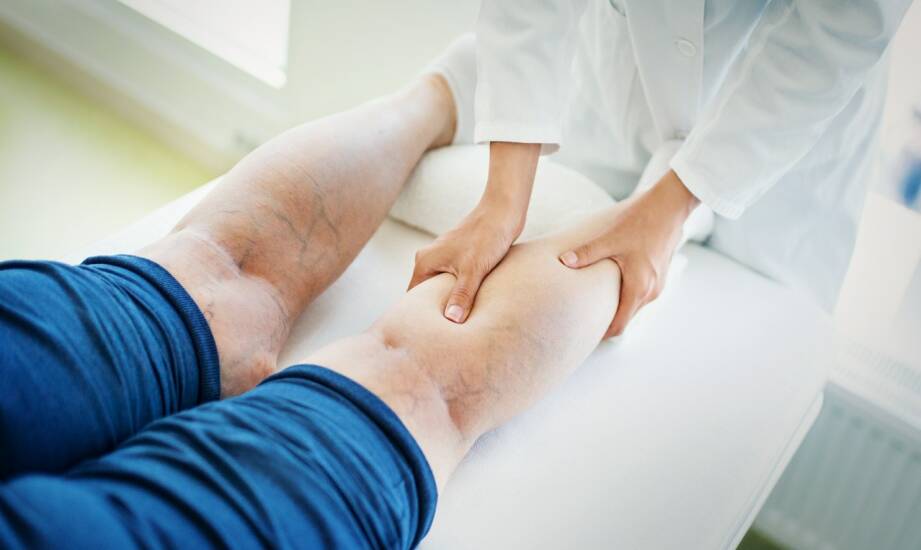Skleroterapia: czym jest, korzyści i przebieg zabiegu dla zdrowych żył