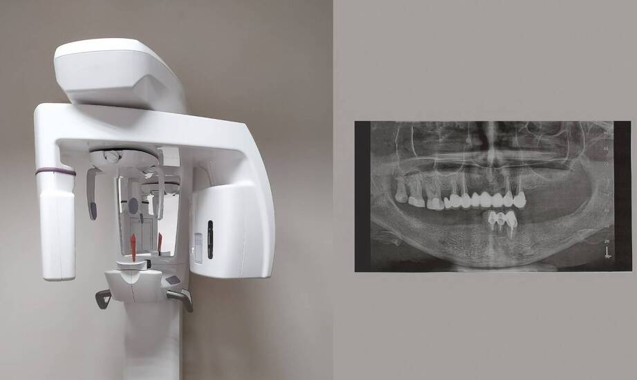 Kiedy dentysta zleca cefalometrię, CBCT lub badanie stawów skroniowo-żuchwowych