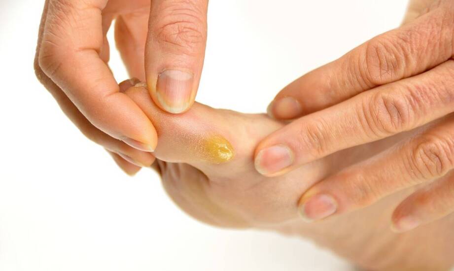 Jak przygotować się do konsultacji dermatologicznej, żeby lekarz lepiej ocenił problem skóry