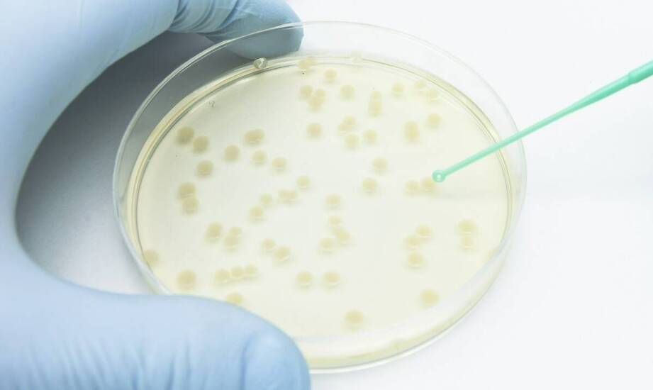 Szalki Petriego w laboratorium mikrobiologicznym: jakie parametry wpływają na pracę z próbkami