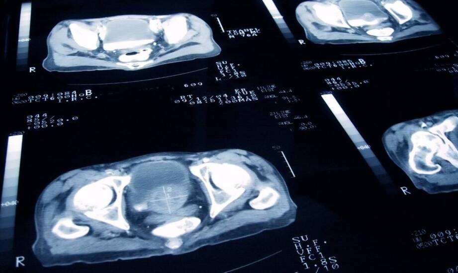 Kiedy nietrzymanie moczu wymaga diagnostyki uroginekologicznej zamiast zwykłej kontroli