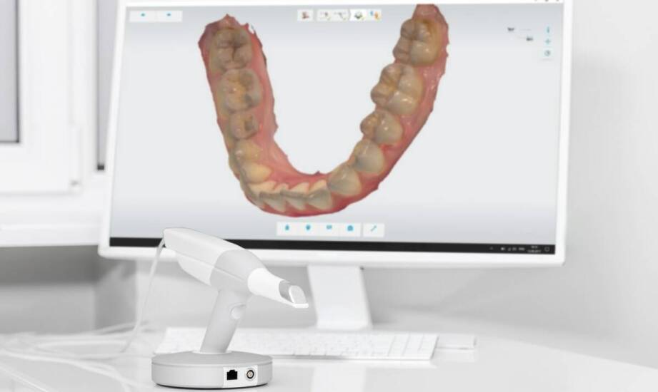 Diagnostyka 3D przed leczeniem nakładkami — co ocenia ortodonta przed planem terapii