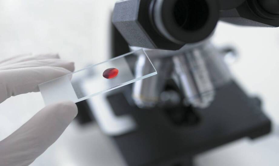 Jak rodzaj szkiełka wpływa na wiarygodność obserwacji w laboratorium chemicznym