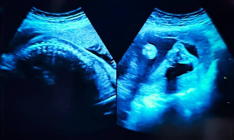 USG w diagnostyce dolegliwości — kiedy badanie wyjaśnia ból, a kiedy wymaga uzupełnienia