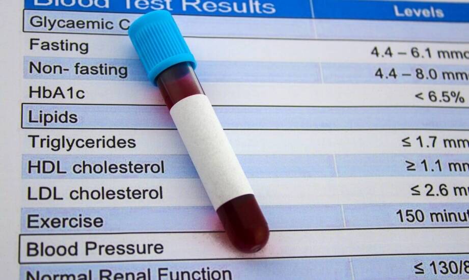 Dlaczego dodatni wynik testu na boreliozę nie kończy jeszcze diagnostyki