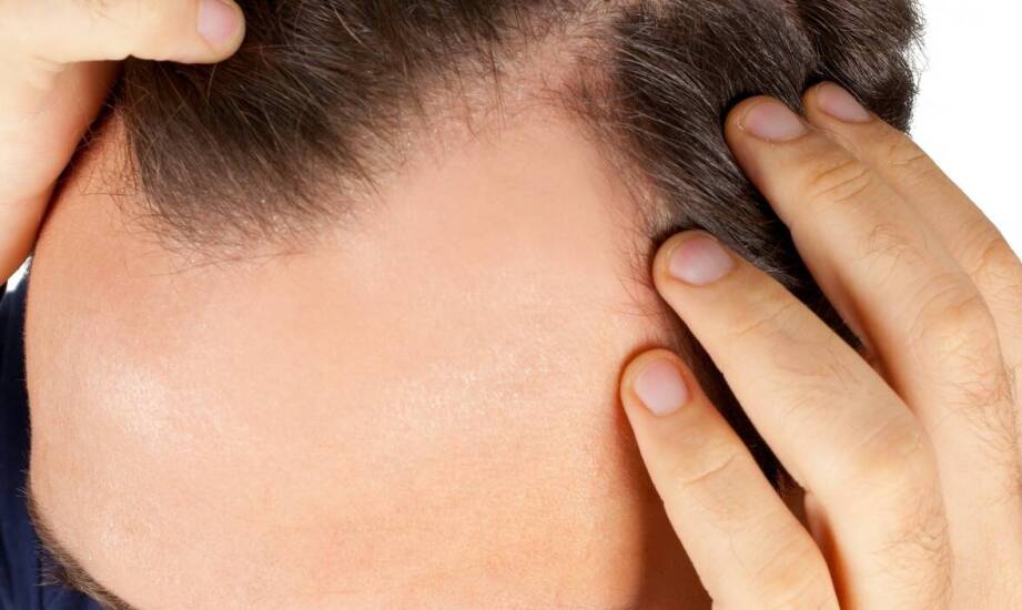 Trycholog w Polsce — kompetencje, kwalifikacje i granice współpracy z dermatologiem