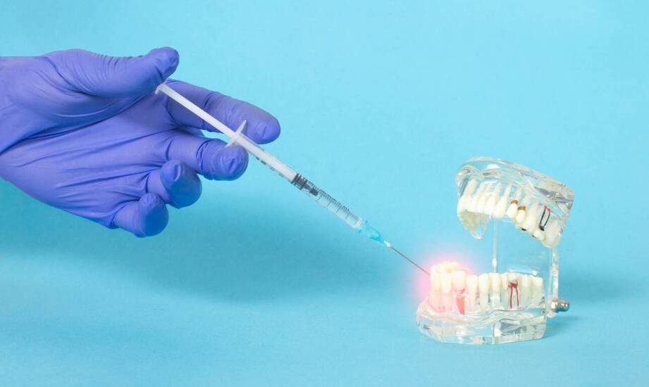Bioceramiczny uszczelniacz kanałowy w praktyce endodontycznej: co zmienia względem żywicznych uszczelniaczy