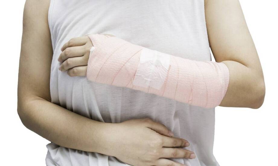 Gips syntetyczny czy tradycyjny — który łatwiej utrzymać w domu po urazie