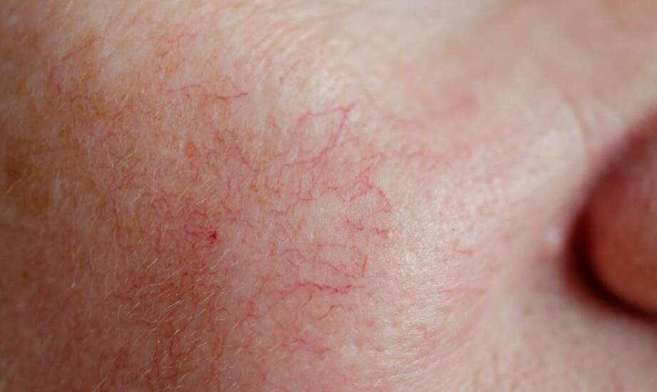 Jak odróżnić przebarwienia na twarzy wymagające diagnostyki, zanim rozważy się laser