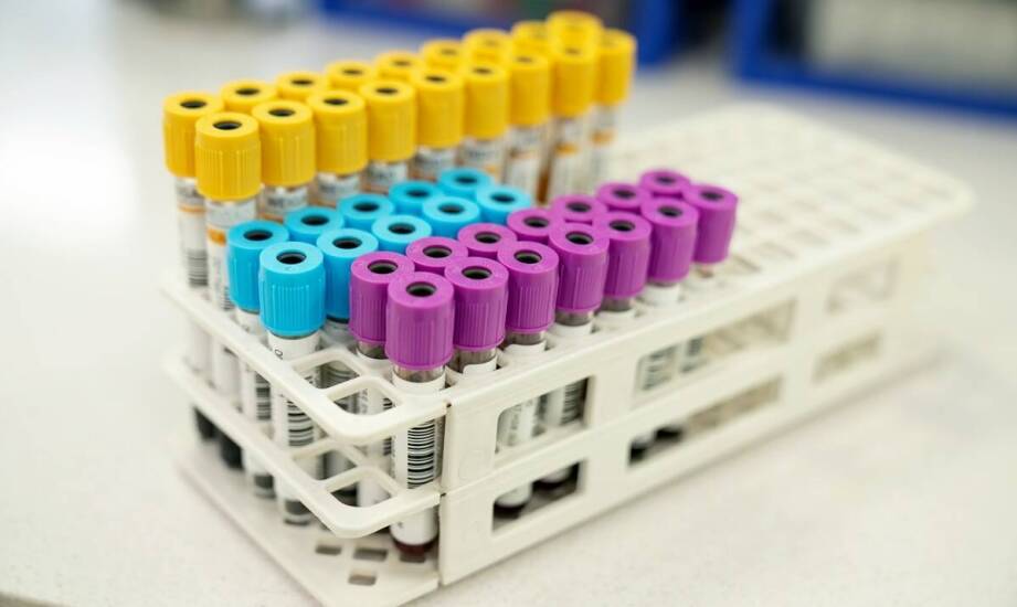 Jak ocenić pojemniki 3–5 ml dla próbek kosmetycznych pod kątem stabilności i identyfikacji serii