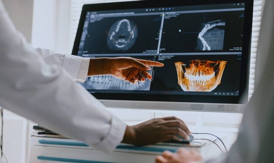 Dlaczego tomografia 3D ujawnia problemy, których nie widać przed leczeniem kanałowym