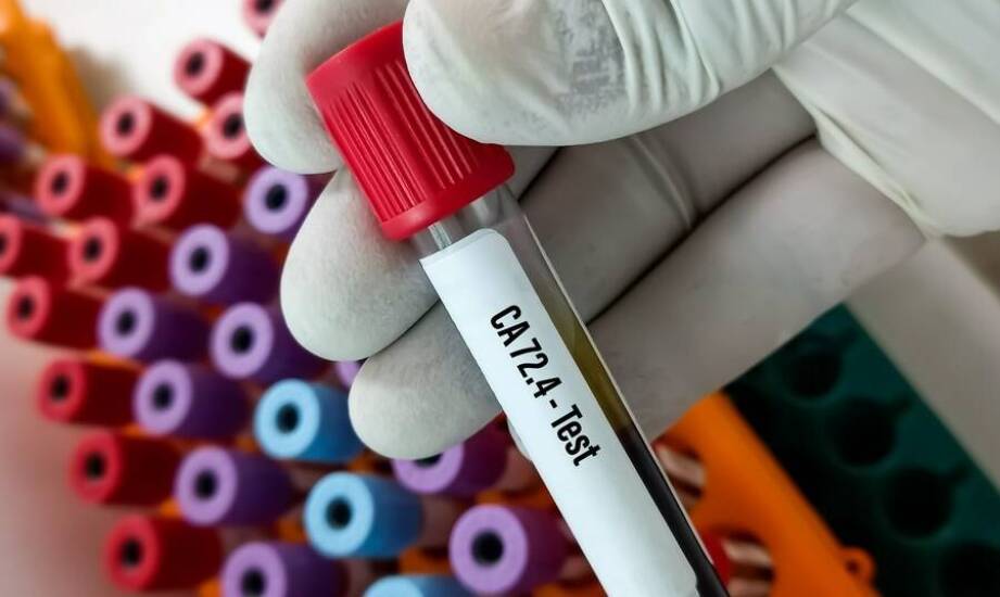 Jak dobrać etykietę do próbki w laboratorium, gdy liczą się chłód i chemia