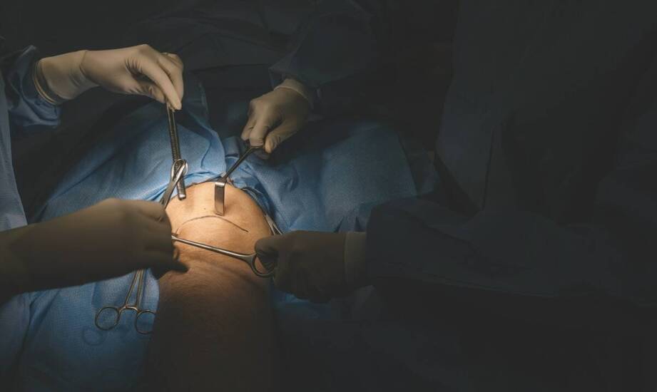 Od czego naprawdę zależy wycena osteotomii kolana u aktywnego pacjenta