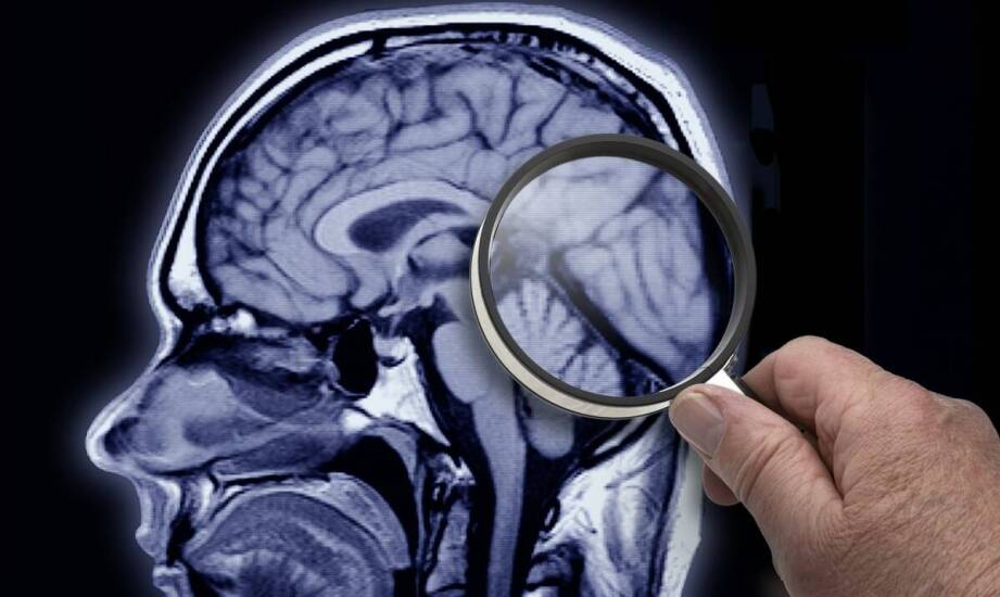 Oponiak przy podstawie czaszki — kiedy objawy oczne i neurologiczne wymagają pogłębionej diagnostyki