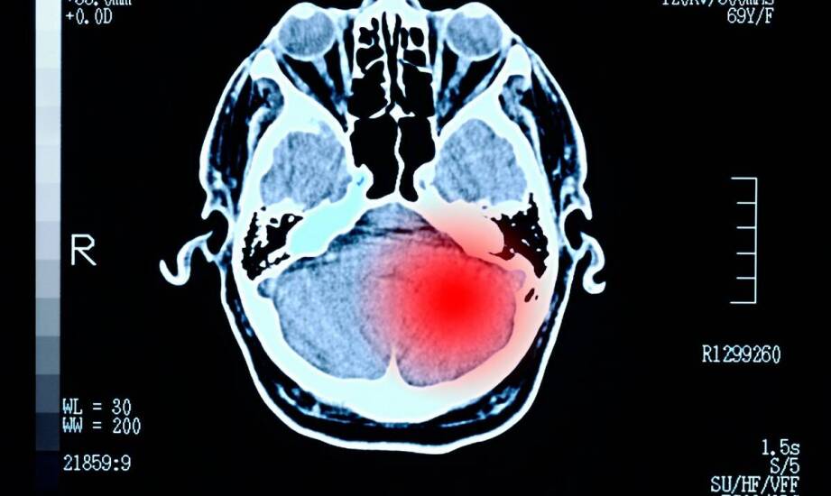 Jak anatomia guza podstawy czaszki przesądza o potrzebie dostępu mikrochirurgicznego