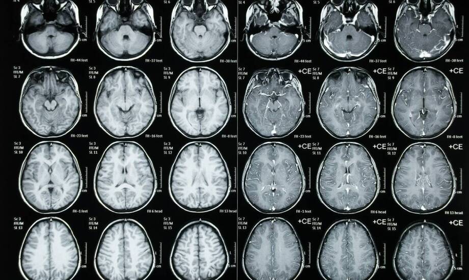Kiedy neurologiczne objawy wymagają konsultacji neurochirurgicznej i pilnej diagnostyki obrazowej