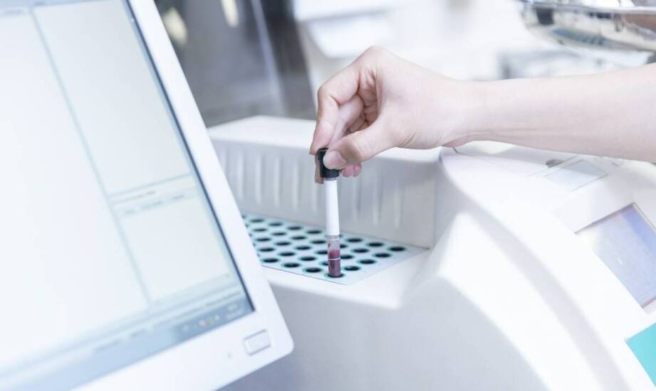 Test potowy, panel CFTR i sekwencjonowanie — jak kolejne etapy porządkują rozpoznanie mukowiscydozy