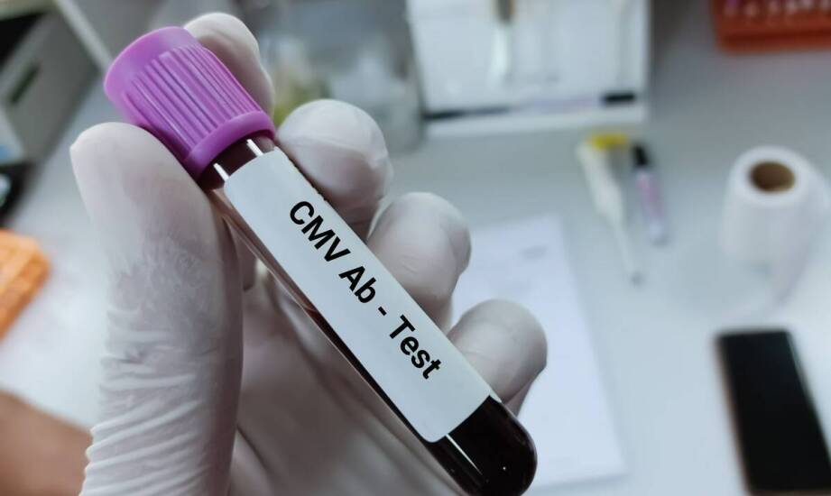 Co decyduje o wiarygodności oznaczania pp65 CMV w laboratorium diagnostycznym