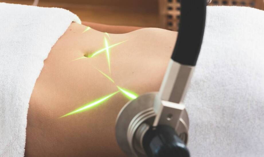 Jak laser podgrzewa tkankę tłuszczową i dlaczego skóra się obkurcza