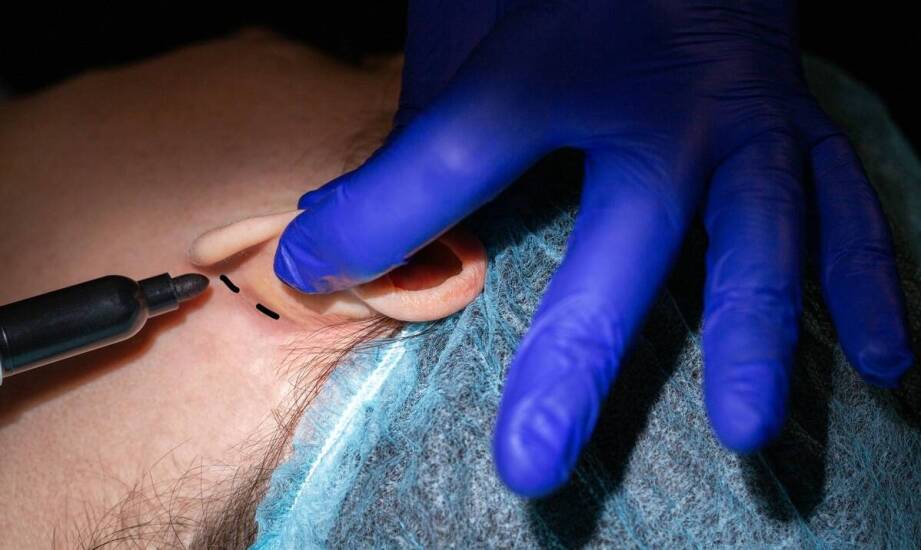 Kiedy odstające uszy kwalifikują do otoplastyki i jak przebiega gojenie po zabiegu