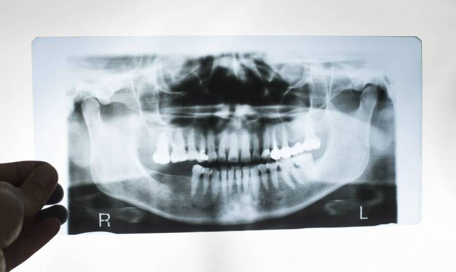 Co lekarz sprawdza na pantomogramie i CBCT przed implantem?