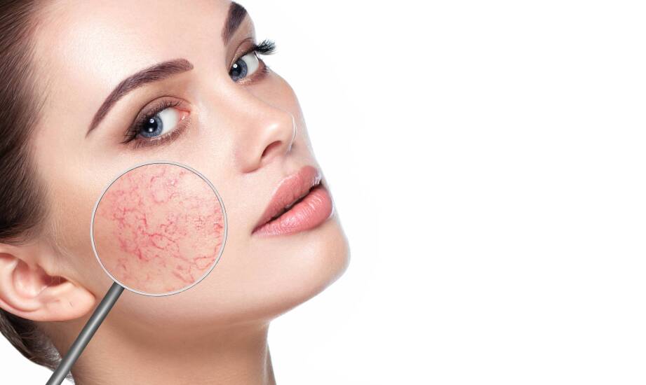 Kiedy problem skóry po 30. roku życia wymaga lekarza, dermatologa albo chirurga plastycznego