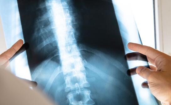 Procesy kontroli jakości i zapewnienia spójności diagnostycznej w modelu zewnętrznej oceny obrazów rentgenowskich