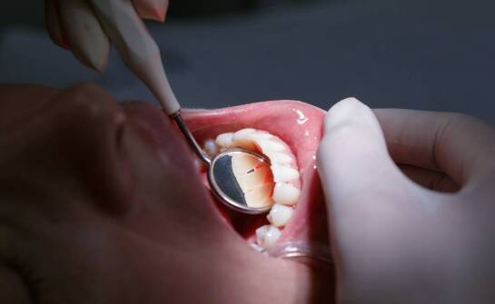Leczenie endodontyczne – dlaczego jest niezbędne dla zdrowia zębów?