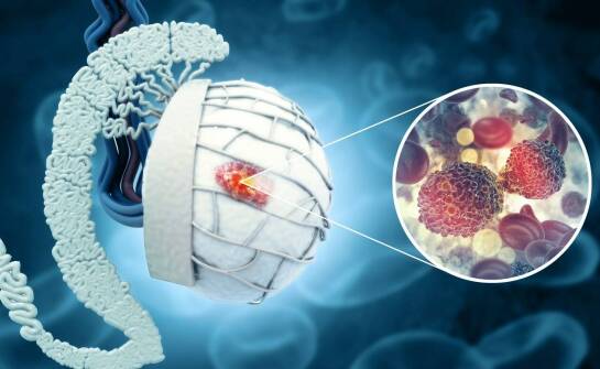 Jakie objawy neurologiczne mogą towarzyszyć oponiakom mózgu?
