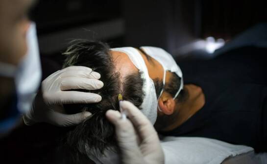 Kiedy warto skonsultować się z dermatologiem w przypadku łysienia?