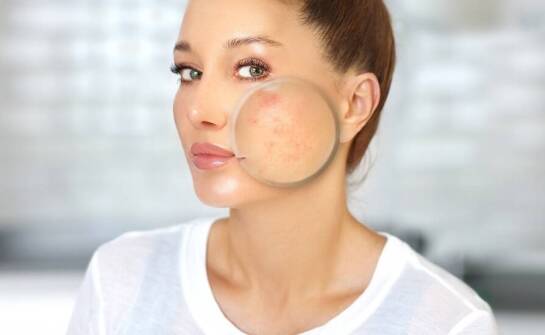 Dermatolog estetyczny a innowacyjne metody leczenia blizn