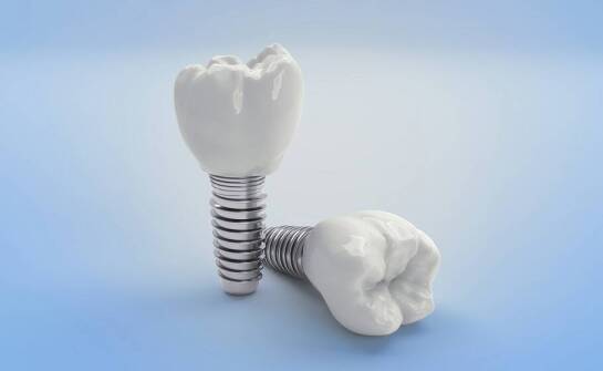Różnice między implantami jedno- i dwufazowymi – co wybrać?