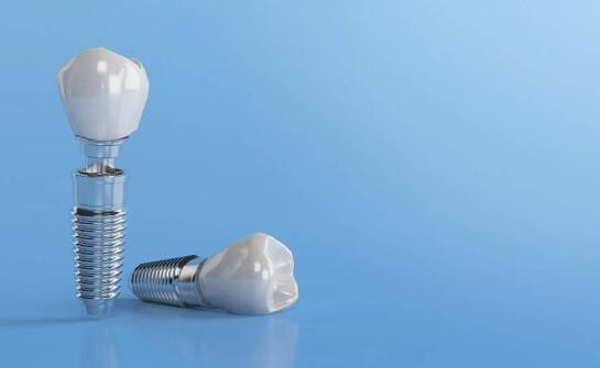 Przewaga implantów dentystycznych nad tradycyjnymi protezami